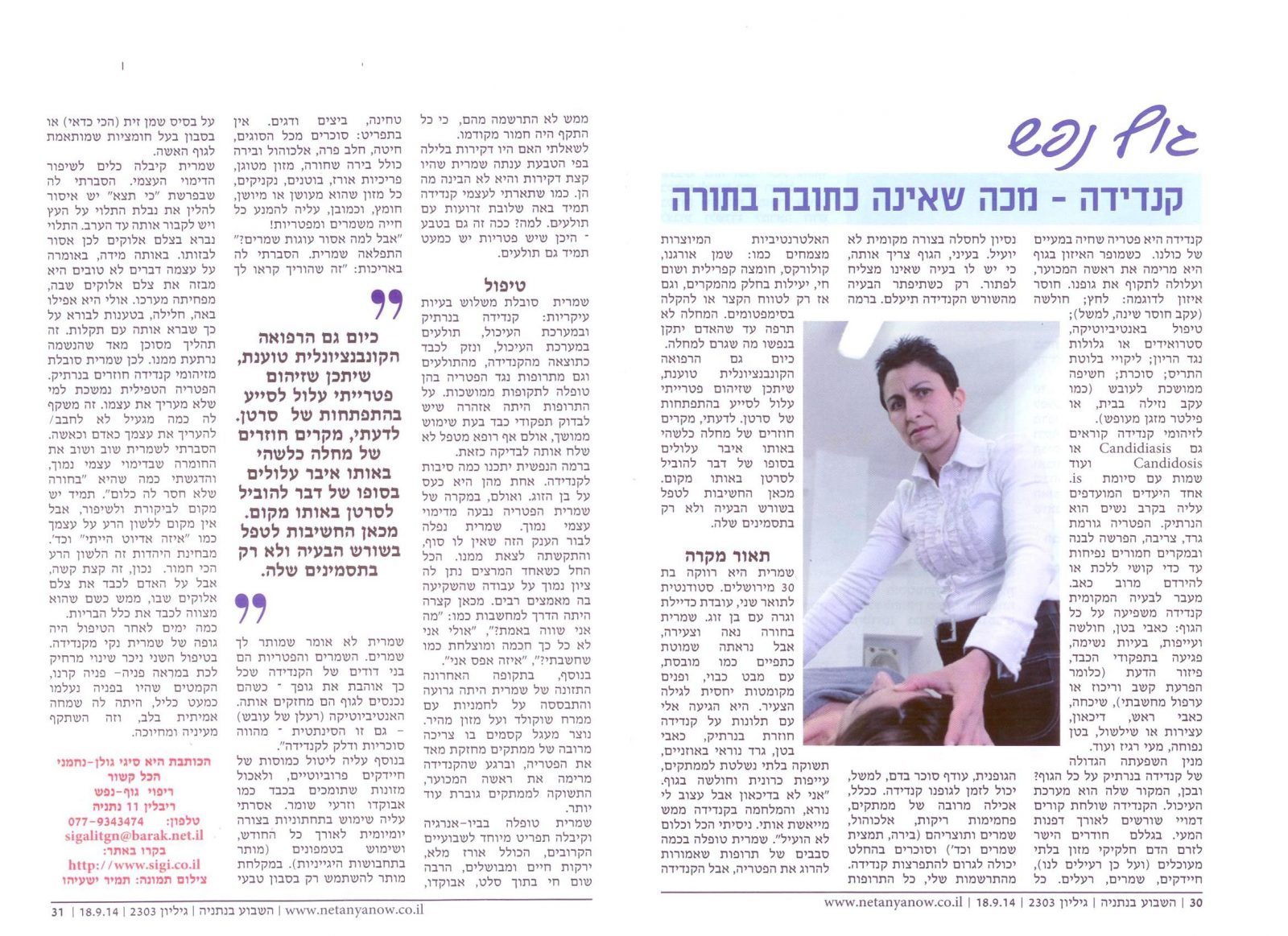 טור 16 קנדידה